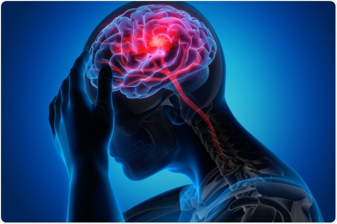 Traumatic Brain Injury/Injuries From Accident